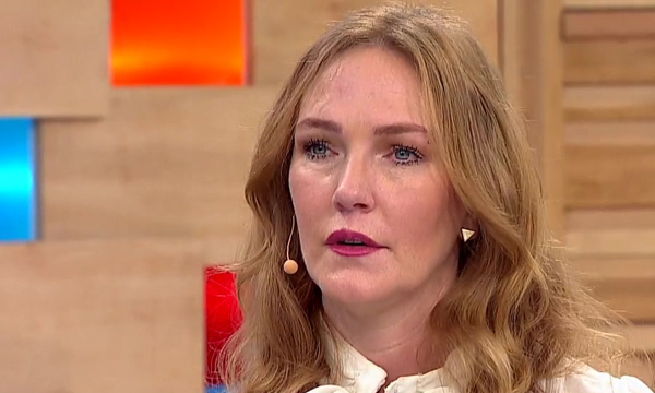 Catalina Pulido: Tratamiento estético y su increíble cambio