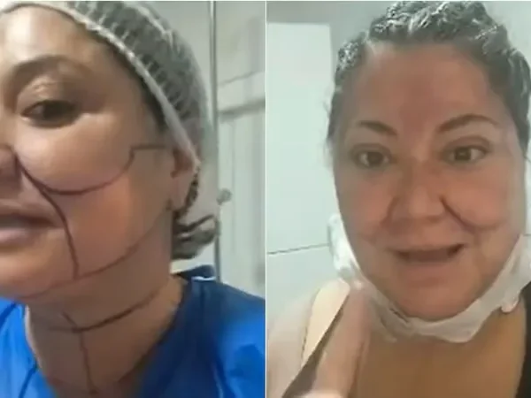 Procedimiento estético Denisse Campos: su asombrosa transformación