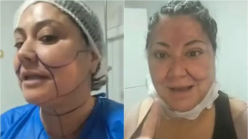 Procedimiento estético Denisse&hellip;